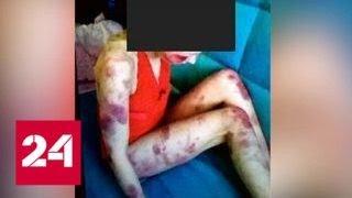 Ревнивец забил жену до смерти, а фото выложил в Интернет - Россия 24