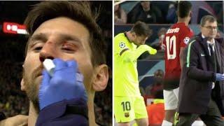 Как МЕССИ вчера сломали лицо! Ужасная травма! Манчестер Юнайтед - Барселона