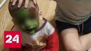В Подольске арестовали женщину, до смерти избившую трехлетнего малыша - Россия 24