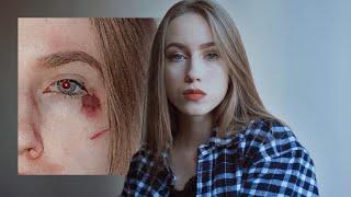 Я ПОПАЛА В АВАРИЮ...