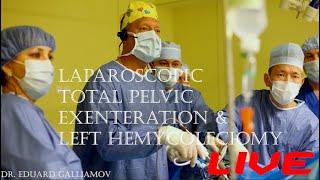 Total pelvic exenteration &left hemycoleciomy LIVE/Тотальная супралеваторная экзентерация&гемиколэкт
