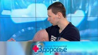 Здоровье. Выпуск от 01.09.2019