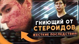 Ужасные последствия стероидов! Продолжение истории