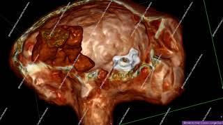 МРТ-сканирование головы инопланетянина